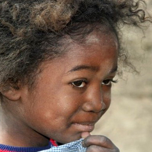 La santé - Apporter des soins aux enfants de Madagascar